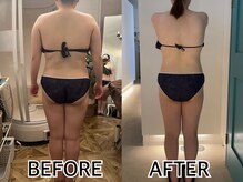 インプルーブ エステティック(Improve ESTHETIC)/〈1年通っているお客様〉