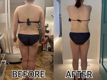 インプルーブ エステティック(Improve ESTHETIC)/〈1年通っているお客様〉