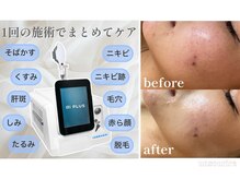アンスリール(unsourire)の雰囲気（シミ/くすみ/毛穴の開き/ニキビケアしながら脱毛◎）