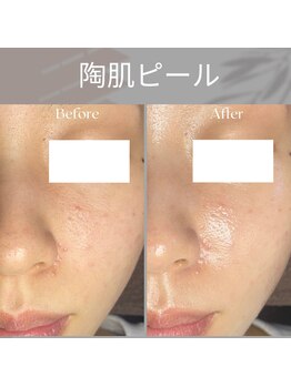 ブラックボックス(BLACK BOX)/20代女性のお客様