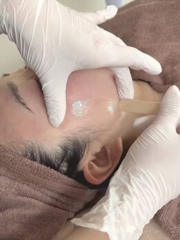 顔脱毛がしたい