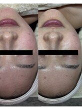 コルザフラワー(charroux flower)/セラピール