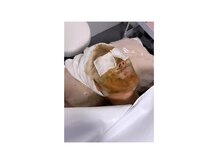 シャイン(SHINE)の雰囲気（ボディもフェイシャルもOK。小顔矯正付き新ハーブピーリング♪）