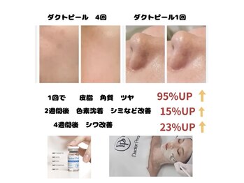 シュシュ(chouchou)/圧倒的オススメ ダクトピール