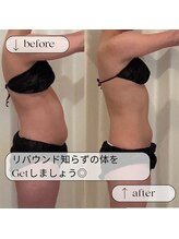 ヨサパーク フェリニタ(YOSA PARK felinita)