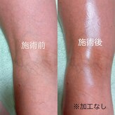 ミルク(MILC)