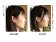 コアサロン(58SALON)の写真/【劇的効果で大人気】小顔矯正♪当店人気No.1メニュー☆スッキリ小顔を目指すなら当店にお任せ下さい！