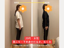 ソルム(solmu)/