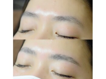 光/ハリウッドブロウリフト