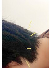 美巡究 南麻布/【後頭下筋群】眼精疲労や頭痛