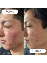 ケースタイル(k.style)/肌質改善♪