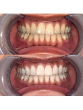 ライトビューティー 池袋店(LightBeauty)/症例写真