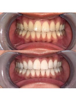 ライトビューティー 池袋店(LightBeauty)/症例写真