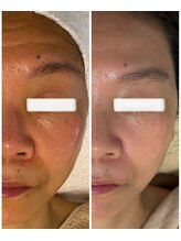 クールグラシュー(couer gracieux)/＃肌質改善にも◎