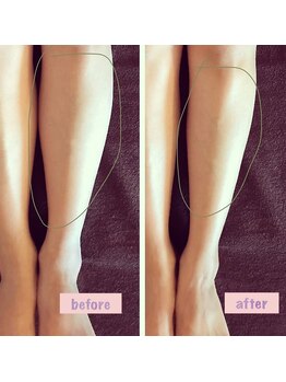 フェローズリンパケア(FELLOWS)/足首むくんでいませんか?