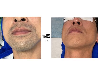 ヴォーグ(VOGUE)の写真