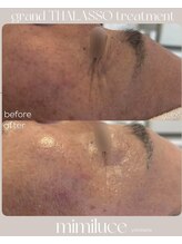 ミミルーチェ(mimiluce)/タラソトリートメント