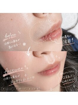 ダズル さいたま新都心(DAZZLE)/フェイスワックス/部分ワックス