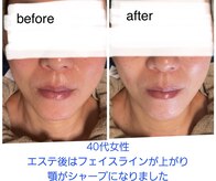 ラカン ビューティーアンドスキン(Lacan beauty&skin)