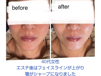 ラカン ビューティーアンドスキン(Lacan beauty&skin)の写真