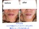 ラカン ビューティーアンドスキン(Lacan beauty&skin)の写真