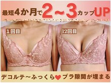 バストサロン メルベイユ(Merveile)