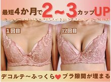 バストサロン メルベイユ(Merveile)