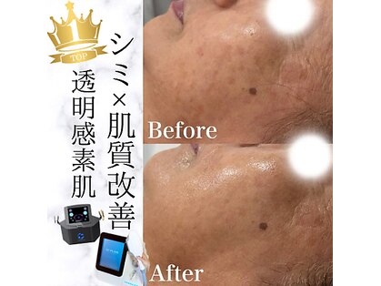 トータルビューティー ミミ(Total Beauty mimi)の写真