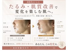 グロウ バイ フェイシャルデザイン アンド アイ(GROW)