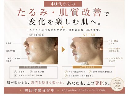 グロウ バイ フェイシャルデザイン アンド アイ(GROW)の写真