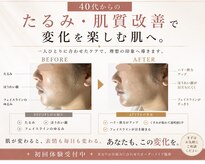 グロウ バイ フェイシャルデザイン アンド アイ(GROW)