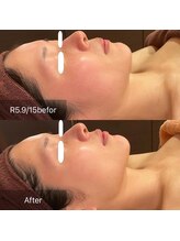 サンベリーナ(Thumbelina)/シンデレラケア