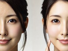 レア 御徒町2号店(Lea)の雰囲気（「Rene-Cell化粧品」効果がデータに基づいている信頼性が高い）