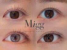 ミグ(Migg)