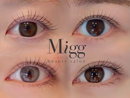 ミグ(Migg)の写真