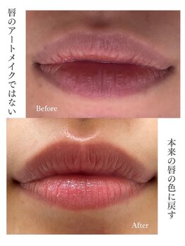 リュミエール デスポワール(Lumiere d'espoir)/ローマピンク