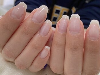シャンス(chance)の写真/爪のピンクの部分を縦長に伸ばしたい/脆く割れやすい/二枚爪/丸爪/チビ爪/縦じわ/爪の形などでお悩みの方へ