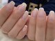 シャンス(chance)の写真/爪のピンクの部分を縦長に伸ばしたい/脆く割れやすい/二枚爪/丸爪/チビ爪/縦じわ/爪の形などでお悩みの方へ