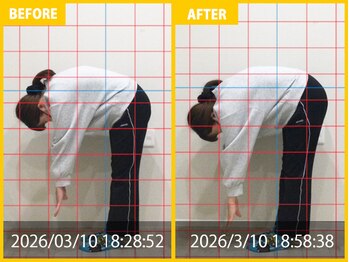 整体院 元 くまなん店/20代女性 ひどい腰痛の悩み