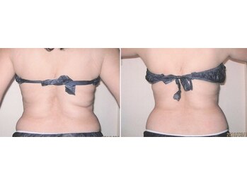 アルメリア(Armeria)/【結果写真】