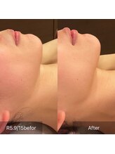 サンベリーナ(Thumbelina)/シンデレラケア