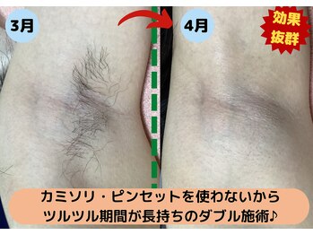 ディスイズミー シュガーリング(This is me Sugaring)