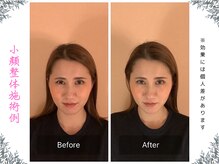 ボディ リセット アンド デザイン(Body Reset & Design)/【施術例】ビフォーアフター