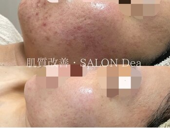 サロンディア(SALON Dea)