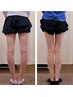 【1日1名限定】【まっすぐな美脚に改善】O脚矯正初回体験11,000円→2,980円