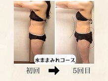 ヨサパーク シアー(YOSA PARK sheer)