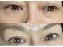 トータルビューティーサロンリア(Li'a)の雰囲気（半年で劇的変化！オペを諦めた瞼を救う革新ケアで若さ復活！）
