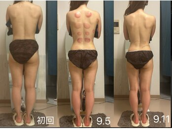 オーシャンブルーム 目黒(OceanBloom)/