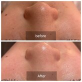 コンジュ(kongju)