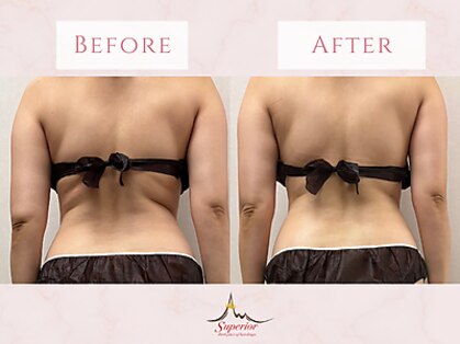 スーペリオル(Superior)の写真